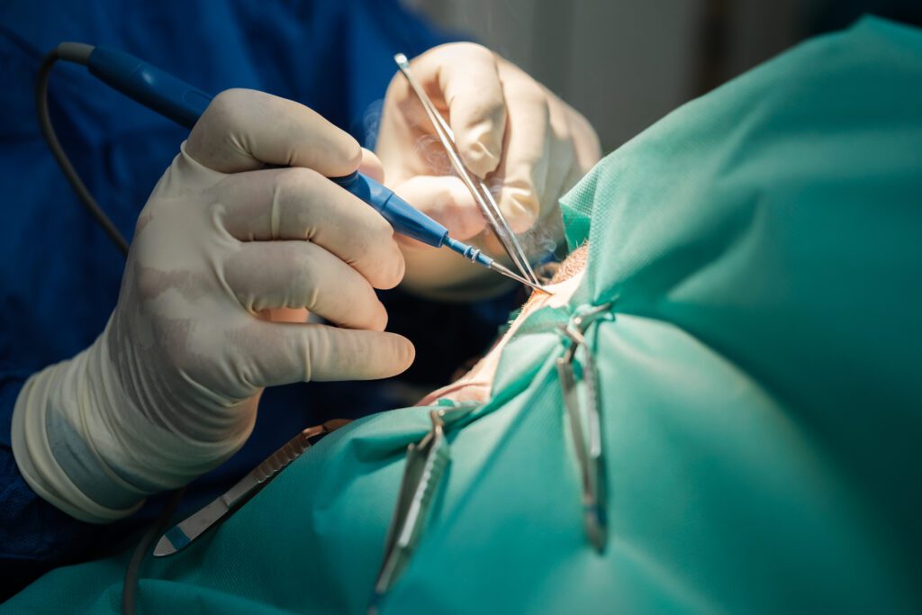 Surgeon's hands performing a surgical intervention with electro scalpel. Concept: medicine, health care